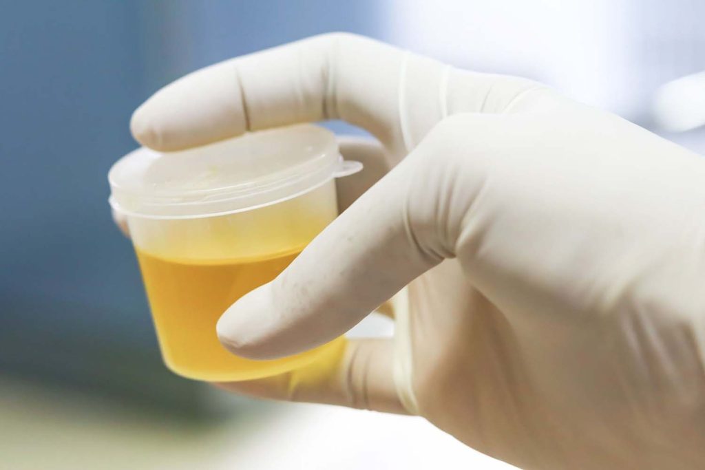 Synthetic Urine for Emergency Medical Uses: Applications and Benefits