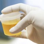 Synthetic Urine for Emergency Medical Uses: Applications and Benefits